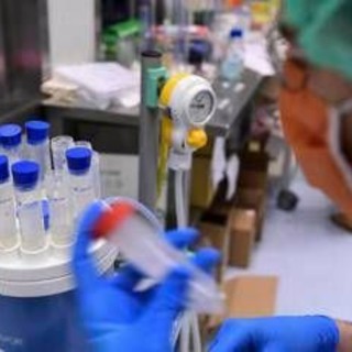 Legionella, il batterio che ama tubature e condizionatori: casi in aumento in Italia Legionella, il batterio che ama tubature e condizionatori: casi in aumento in Italia