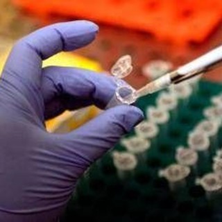 Focolaio di Legionella a Milano: 1 morto e 11 casi in zona San Siro: in corso le indagini di Ats Focolaio di Legionella a Milano: 1 morto e 11 casi in zona San Siro: in corso le indagini di Ats