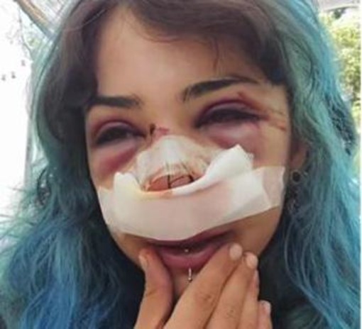 Bari, studentessa picchiata al parco: indagati per lesioni e rapina custode bagni e il compagno Bari, studentessa picchiata al parco: indagati per lesioni e rapina custode bagni e il compagno