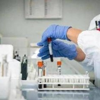 Tumori, Cremolini (UniPi): "Dostarlimab efficace in 70% pazienti con raro tipo cancro al retto"