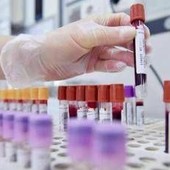 Allarme oncologi: "- 50% trial in Europa in 10 anni mentre Cina accelera"