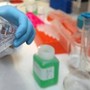 Cancro alla vescica, Berardi (Aiom): "Sangue nelle urine segnale da non sottovalutare" Cancro alla vescica, Berardi (Aiom): "Sangue nelle urine segnale da non sottovalutare"